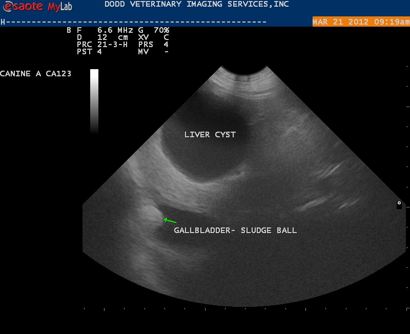 New Ultrasound Machine - Cyst in Liver